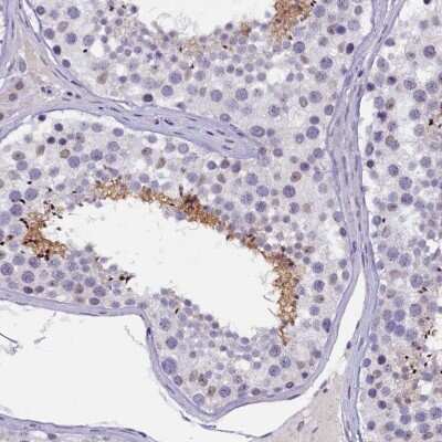 Immunohistochemistry-Paraffin: KIAA1683 Antibody [NBP1-85833] - Staining of human testis shows high expression.