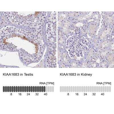 Immunohistochemistry-Paraffin: IQCN Antibody [NBP1-85833] - KIAA1683 Antibody [NBP1-85833] - Staining in human testis and kidney tissues using anti-KIAA1683 antibody. Corresponding KIAA1683 RNA-seq data are presented for the same tissues.
