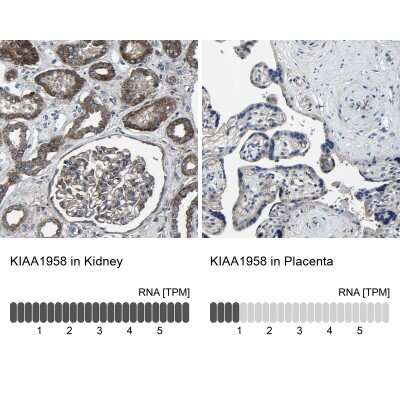 Immunohistochemistry-Paraffin: KIAA1958 Antibody [NBP1-81929] - Staining in human kidney and placenta tissues using anti-KIAA1958 antibody. Corresponding KIAA1958 RNA-seq data are presented for the same tissues.