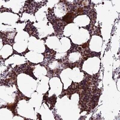 Immunohistochemistry-Paraffin: KIAA1984 Antibody [NBP1-94134] - Staining of human bone marrow shows strong cytoplasmic and nuclear positivity in hematopoietic cells.