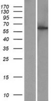 Western Blot: KIAA1984 Overexpression Lysate (Adult Normal) [NBP2-08571] Left-Empty vector transfected control cell lysate (HEK293 cell lysate); Right -Over-expression Lysate for KIAA1984.