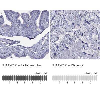 Immunohistochemistry-Paraffin: KIAA2012 Antibody [NBP3-16964] - Analysis in human fallopian tube and placenta tissues using Anti-KIAA2012 antibody. Corresponding KIAA2012 RNA-seq data are presented for the same tissues.