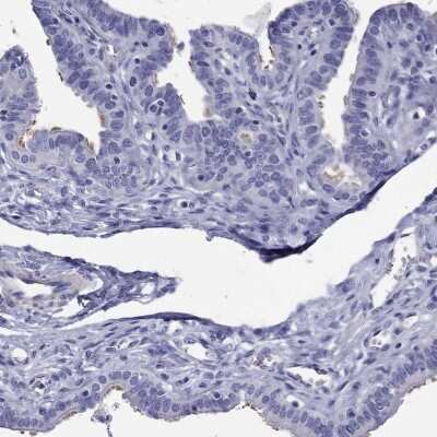 Immunohistochemistry-Paraffin: KIAA2012 Antibody [NBP3-16964] - Staining of human fallopian tube shows high expression.