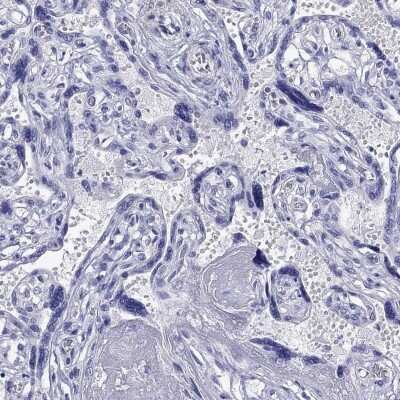 Immunohistochemistry-Paraffin: KIAA2012 Antibody [NBP3-16964] - Staining of human placenta shows low expression as expected.