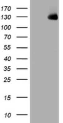 Western Blot: KIBRA Antibody (OTI1H8) - Azide and BSA Free [NBP2-71732] - Analysis of HEK293T cells were transfected with the pCMV6-ENTRY control (Left lane) or pCMV6-ENTRY KIBRA.