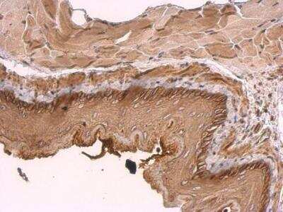 Immunohistochemistry-Paraffin: KIDINS220 Antibody [NBP1-31216] - Paraffin-embedded mouse esophagus. KIDINS220 antibody [C3], C-term  dilution: 1:500.