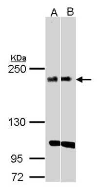 Western Blot: KIDINS220 Antibody [NBP1-31216] - Sample(30 ug whole cell lysate) A:H1299 B:Raji 5% SDS PAGE, antibody diluted at 1:1000.