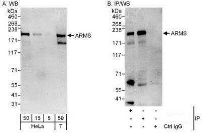 Western Blot: KIDINS220 Antibody [NBP1-50034] - Detection of Human ARMS by Western Blot and Immunoprecipitation.  Samples:  Whole cell lysate from HeLa (5, 15 and 50 mcg for WB; 1 mg for IP, 20% of IP loaded) and 293T (T; 50 mcg) cells.  Antibodies: Affinity purified rabbit anti-ARMS antibody used for WB at 0.1 mcg/ml (A) and 1 mcg/ml (B) and used for IP at 6 mcg/mg lysate.  ARMS was also immunoprecipitated by rabbit anti-ARMS antibody which recognizes a downstream epitope.  For blotting immunoprecipitated ARMS, the ReliaBLOT Reagents and Procedures were used.  Detection: Chemiluminescence with exposure times of 3 minutes (A) and 30 seconds (B).