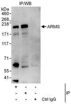 Western Blot: KIDINS220 Antibody [NBP1-50035] - Detection of Human ARMS by Western Blot of Immunoprecipitates.  Samples:  Whole cell lysate (1 mg for IP, 20% of IP loaded) from HeLa cells.  Antibodies: Affinity purified rabbit anti-ARMS antibod used for IP at 6 mcg/mg lysate.  ARMS was also immunoprecipitated by rabbit anti-ARMS antibody which recognizes an upstream epitope.  For blotting immunoprecipitated ARMS was used at 1 mcg/ml, and the ReliaBLOT Reagents and Procedures were incorporated.  Detection: Chemiluminescence with an exposure time of 30 seconds.