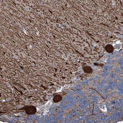 Immunohistochemistry: KIF13A Antibody [NBP1-88757] - Staining of human cerebellum shows strong cytoplasmic positivity in purkinje cells.