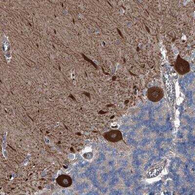 Immunohistochemistry-Paraffin: KIF13A Antibody [NBP1-88758] - Staining of human cerebellum shows strong cytoplasmic positivity in Purkinje cells.