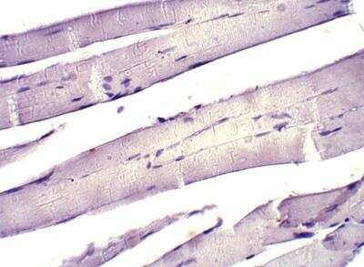 Immunohistochemistry-Paraffin KIF13A Antibody