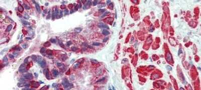 Immunohistochemistry KIF13B Antibody - BSA Free