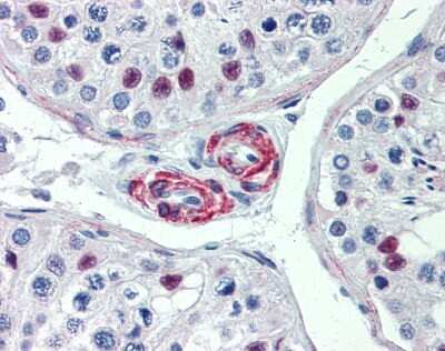 Immunohistochemistry-Paraffin KIF13B Antibody - BSA Free