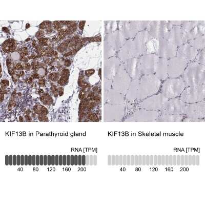Immunohistochemistry-Paraffin KIF13B Antibody - BSA Free