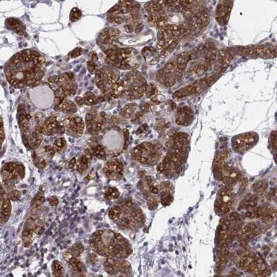 Immunohistochemistry-Paraffin KIF13B Antibody - BSA Free