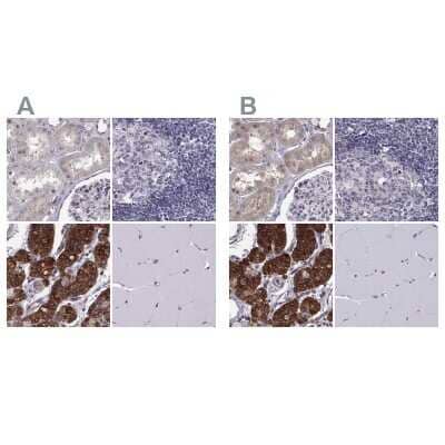 Immunohistochemistry-Paraffin KIF13B Antibody - BSA Free