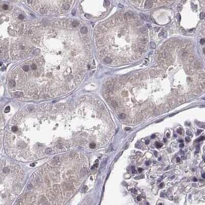 Immunohistochemistry-Paraffin KIF13B Antibody - BSA Free