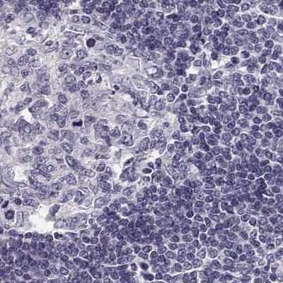 Immunohistochemistry-Paraffin KIF13B Antibody - BSA Free