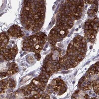 Immunohistochemistry-Paraffin KIF13B Antibody - BSA Free