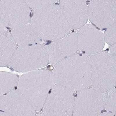 Immunohistochemistry-Paraffin KIF13B Antibody - BSA Free