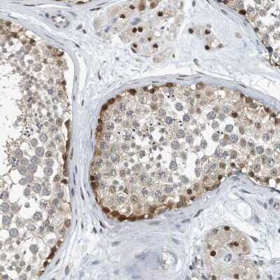 Immunohistochemistry: KIF15 Antibody [NBP2-34009] - Staining of human testis shows strong cytoplasmic and nuclear positivity in cells in seminiferus ducts and strong nuclear staining in leydig cells.