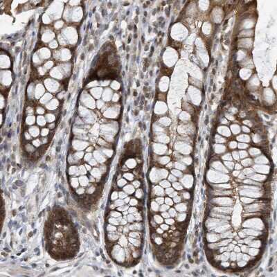 Immunohistochemistry-Paraffin: KIF15 Antibody [NBP1-83252] - Staining of human rectum shows moderate to strong cytoplasmic positivity in glandular cells.