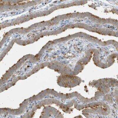 Immunohistochemistry-Paraffin KIF15 Antibody