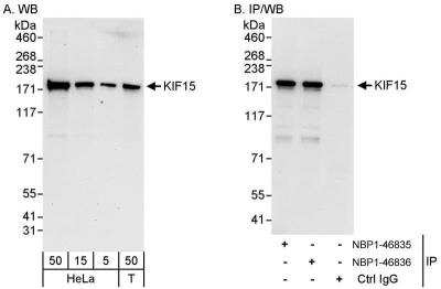 Western Blot: KIF15 Antibody [NBP1-46835] - Samples:  Whole cell lysate from HeLa (5, 15 and 50 ug for WB; 1 mg for IP, 20% of IP loaded) and 293T (T; 50 ug) cells.  Antibodies: Affinity purified rabbit anti-KIF15 antibody NBP1-46835 used for WB at 0.04 ug/ml (A) and 0.4 ug/ml (B) and used for IP at 3 ug/mg lysate.  KIF15 was also immunoprecipitated by rabbit anti-KIF15 antibody NBP1-46836, which recognizes a downstream epitope.  Detection: Chemiluminescence with exposure times of 30 seconds (A) and 10 seconds (B).