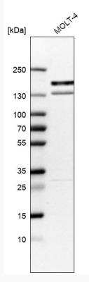 Western Blot: KIF15 Antibody [NBP1-83252] -  Analysis in human cell line MOLT-4.