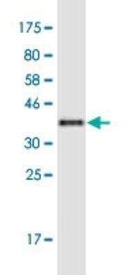 Western Blot: KIF17 Antibody (7C6) [H00057576-M04-100ug] - detection against Immunogen (36.74 KDa) .