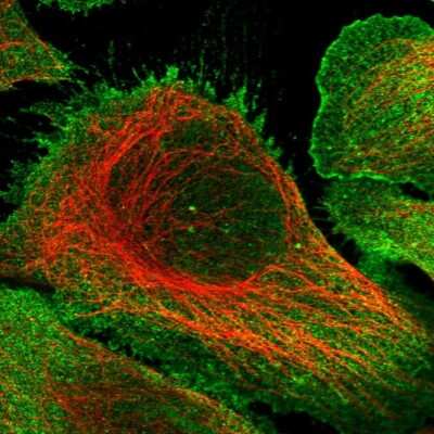 <b>Orthogonal Strategies Validation. </b>Immunocytochemistry/Immunofluorescence: KIF17 Antibody [NBP1-81409] - Immunofluorescent staining of human cell line U-2 OS shows localization to nucleoplasm & plasma membrane.