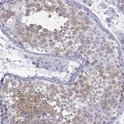 Immunohistochemistry-Paraffin: KIF17 Antibody [NBP1-81409] - Staining of human testis shows high expression.