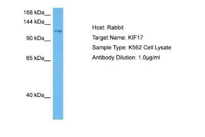 Western Blot: KIF17 Antibody [NBP2-87685] - Host: Rabbit. Target Name: KIF17. Sample Tissue: Human K562 Whole Cell lysates. Antibody Dilution: 1ug/ml