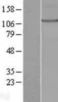 Western Blot: KIF17 Overexpression Lysate (Adult Normal) [NBL1-12287] Left-Empty vector transfected control cell lysate (HEK293 cell lysate); Right -Over-expression Lysate for KIF17.