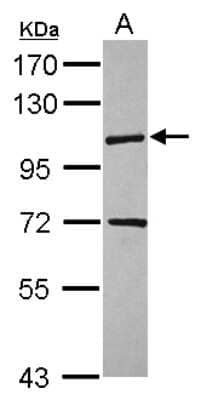 Western Blot: KIF18A Antibody [NBP2-17049] - Sample (30 ug of whole cell lysate) A: HCT116 7. 5% SDS PAGE gel, diluted at 1:5000.