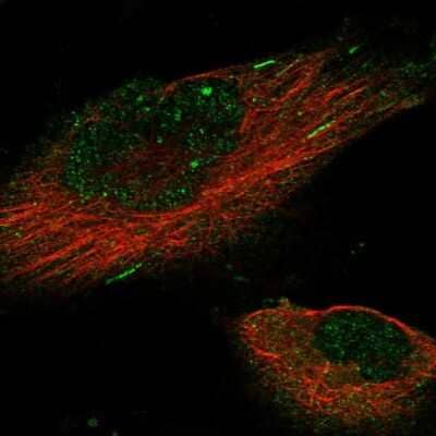 Immunocytochemistry/Immunofluorescence: KIF18B Antibody [NBP1-90882] - Staining of human cell line U-251 MG shows localization to nucleus, cytosol and microtubule ends. Antibody staining is shown in green.
