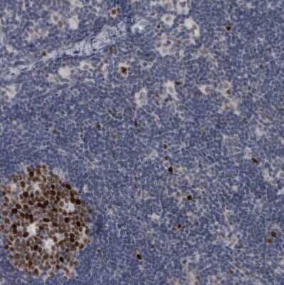 Immunohistochemistry-Paraffin: KIF18B Antibody [NBP1-90882] - Staining of human lymph node shows strong nuclear positivity in germinal center cells.