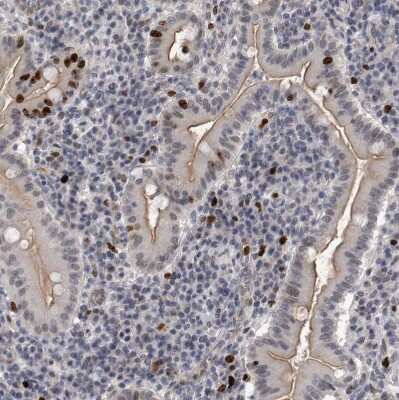 Immunohistochemistry-Paraffin: KIF18B Antibody [NBP1-90882] - Staining of human duodenum shows strong nuclear positivity in a subset of lymphoid cells.