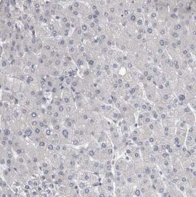 Immunohistochemistry-Paraffin: KIF18B Antibody [NBP1-90882] - Staining of human liver shows no positivity in hepatocytes as expected.