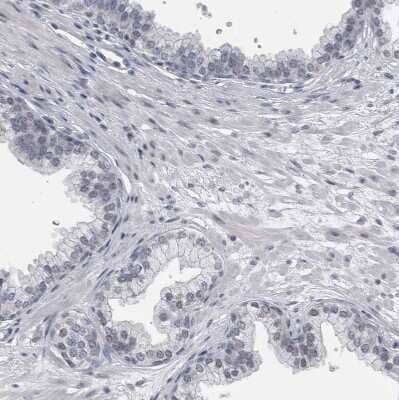 Immunohistochemistry-Paraffin: KIF18B Antibody [NBP1-90882] - Staining of human prostate shows no positivity in glandular cells as expected.