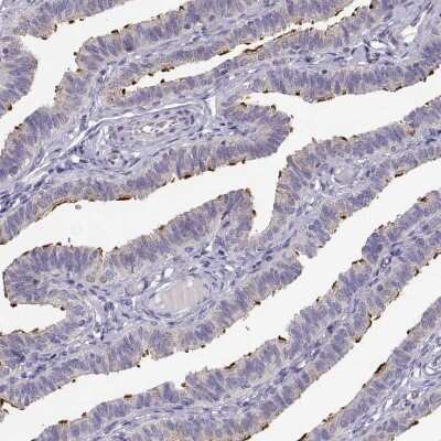 Immunohistochemistry-Paraffin: KIF19 Antibody [NBP2-57895] - Staining of human fallopian tube shows high expression.