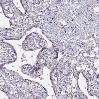 Immunohistochemistry-Paraffin KIF19 Antibody - BSA Free