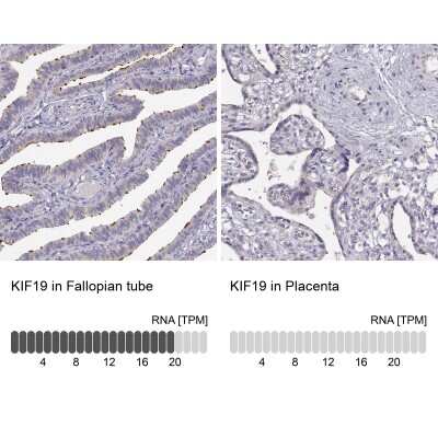 <b>Orthogonal Strategies Validation. </b>Immunohistochemistry-Paraffin: KIF19 Antibody [NBP2-57895] - Staining in human fallopian tube and placenta tissues using anti-KIF19 antibody. Corresponding KIF19 RNA-seq data are presented for the same tissues.