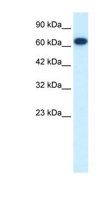 Western Blot: KIF19 Antibody [NBP1-58168] - Jurkat cell lysate, concentration 0.125ug/ml.