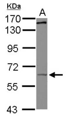 Western Blot: KIF19 Antibody [NBP2-17050] - Sample (30 ug of whole cell lysate) A: HepG2 7. 5% SDS PAGE gel, diluted at 1:500.