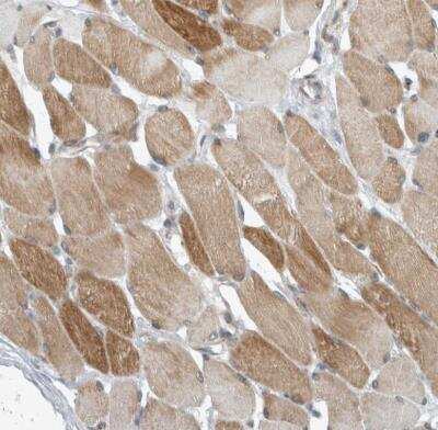 Immunohistochemistry-Paraffin KIF1C Antibody