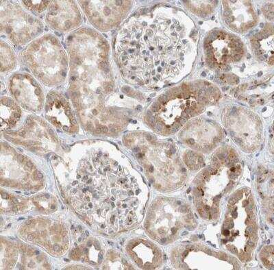 Immunohistochemistry-Paraffin KIF1C Antibody