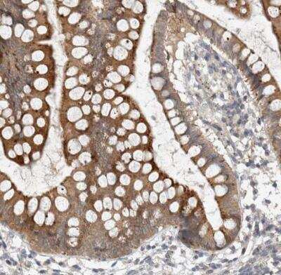 Immunohistochemistry-Paraffin: KIF1C Antibody [NBP1-85978] - Staining of human small intestine shows moderate cytoplasmic positivity in glandular cells.