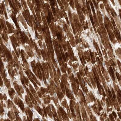 Immunohistochemistry-Paraffin: KIF1C Antibody [NBP1-85978] - Staining of human heart muscle shows strong cytoplasmic positivity in cardiomyocytes.